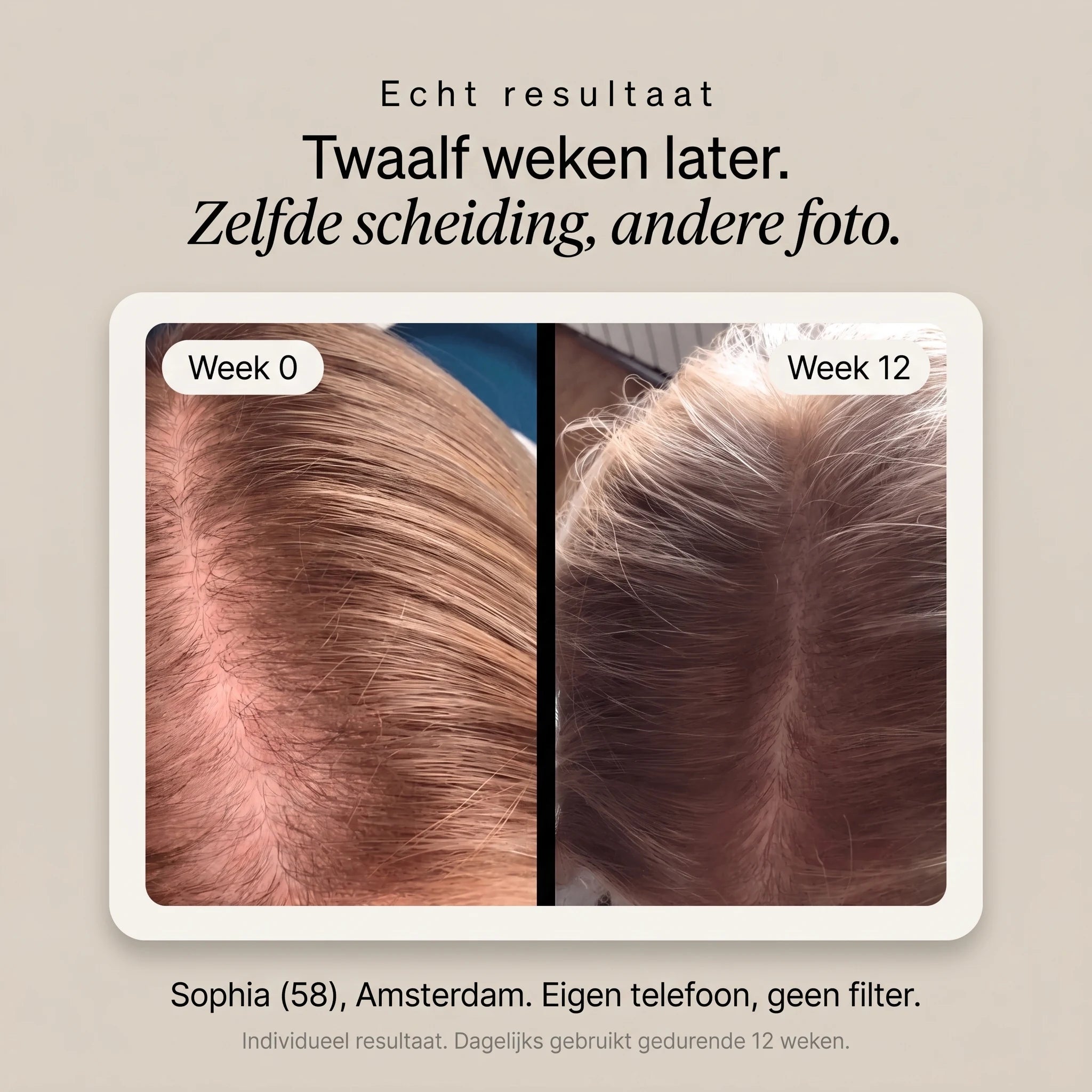 Scalp Activating Serum